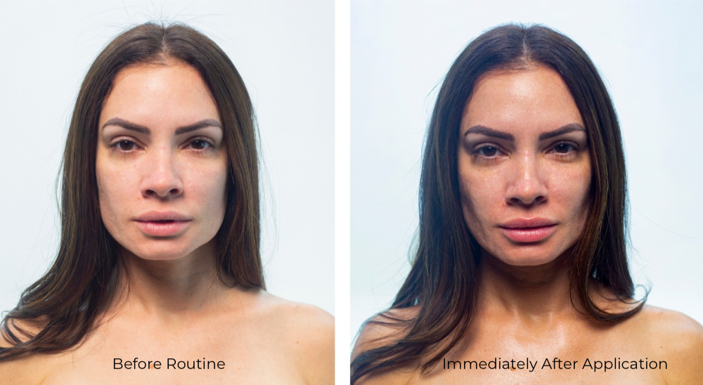 Jorovi skin before and after routine results